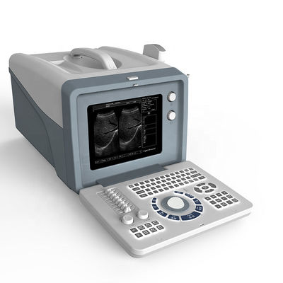 качество  Ultrasound laptop diagnostic ultrasound machine /black and white ultrasound scanner with 15 inch LCD screen завод