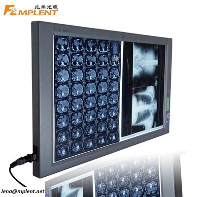 качество  Super Bright Digital Dual General Film Medical Negatoscope LED X Ray Viewer завод