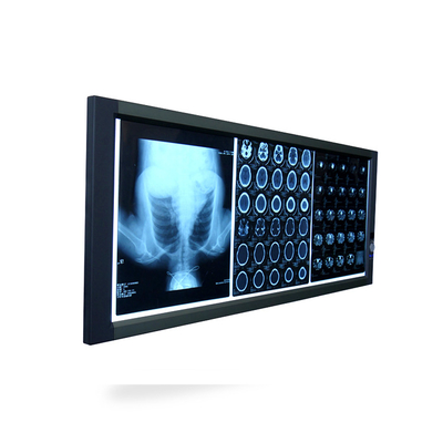 General Film Best Quality Mplent Triple Bank Led X-Ray Film Viewer Box